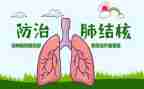 2023年结核病工作计划9篇