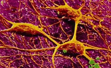 脑神经内科出科个人总结范文5篇