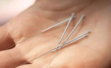 针灸的自我鉴定8篇